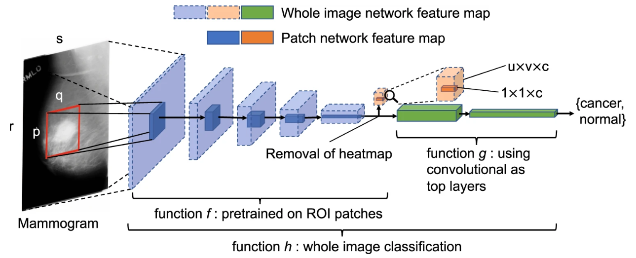 RSNA Breast Cancer Detection